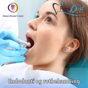 porcelæn tænder pris