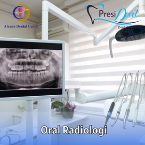 priser tandimplantater